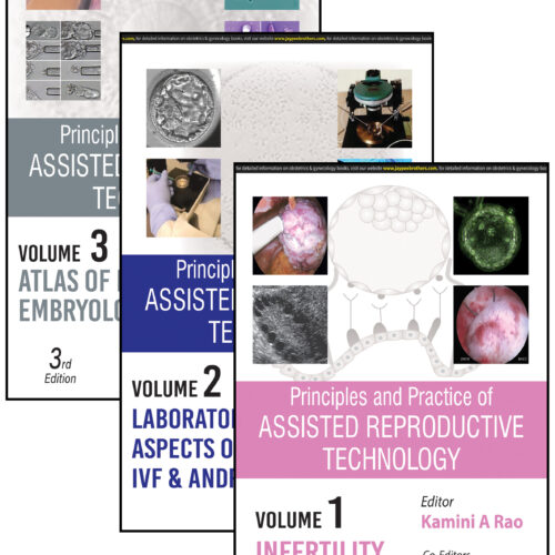 Assisted Reproductive Technology