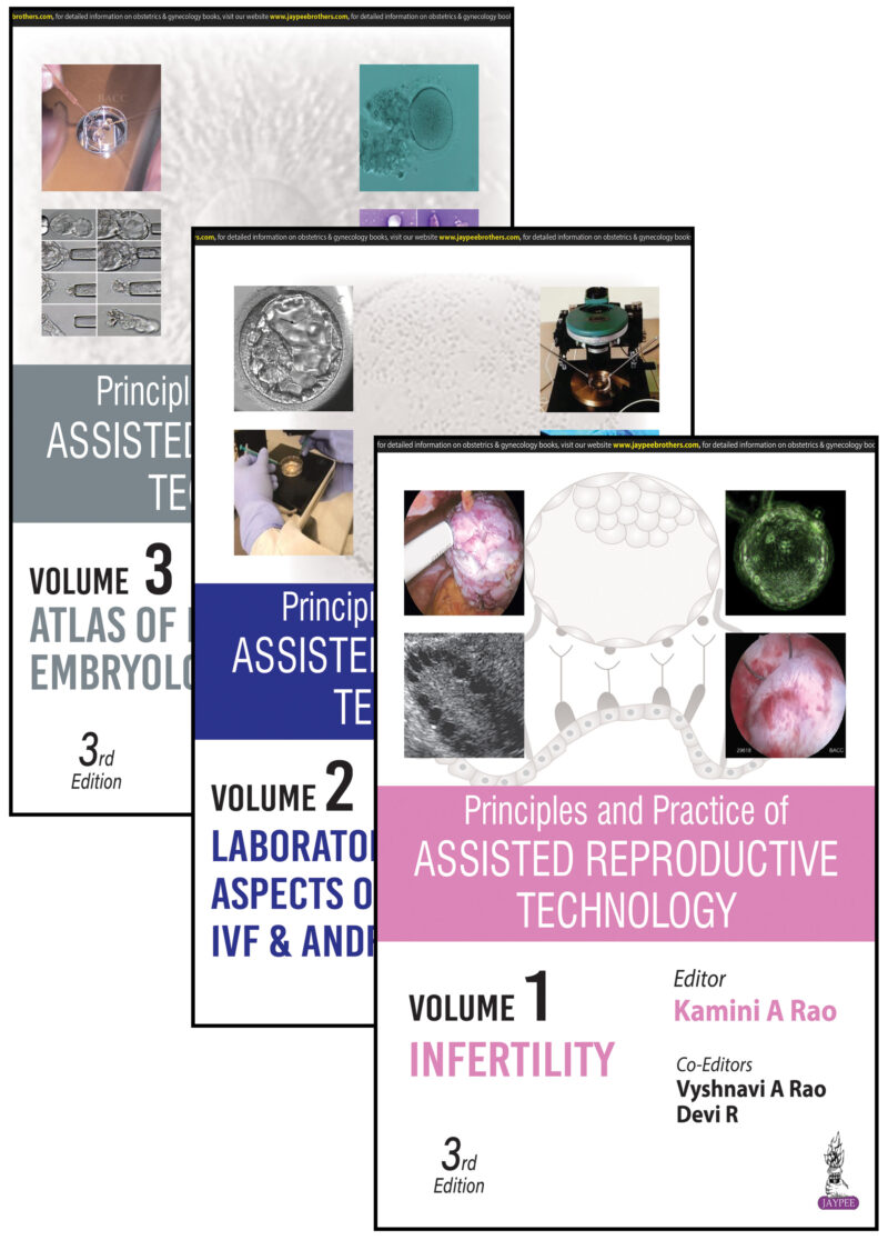 Assisted Reproductive Technology