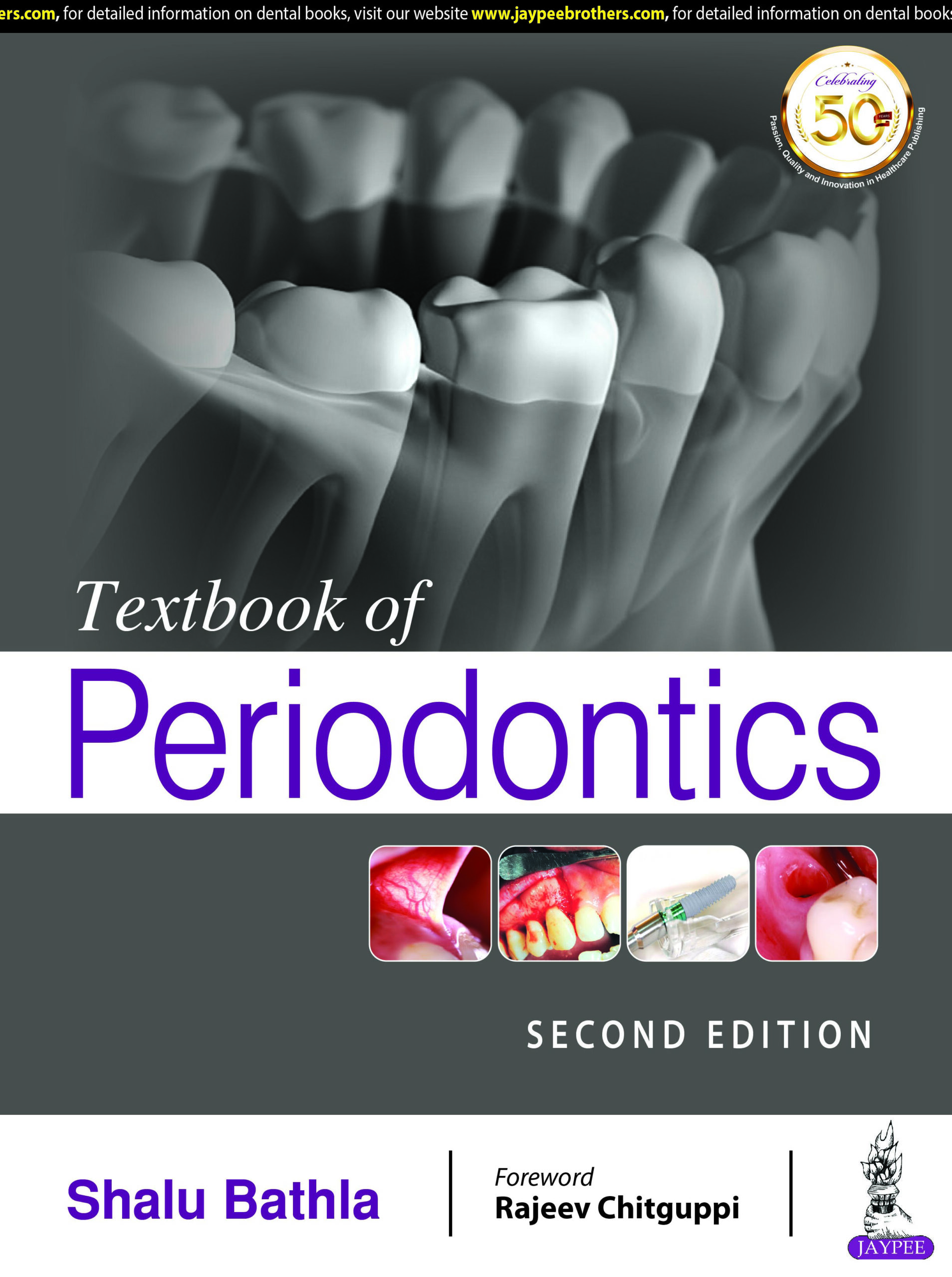 Textbook of Periodontics: Comprehensive Guide to Periodontal
