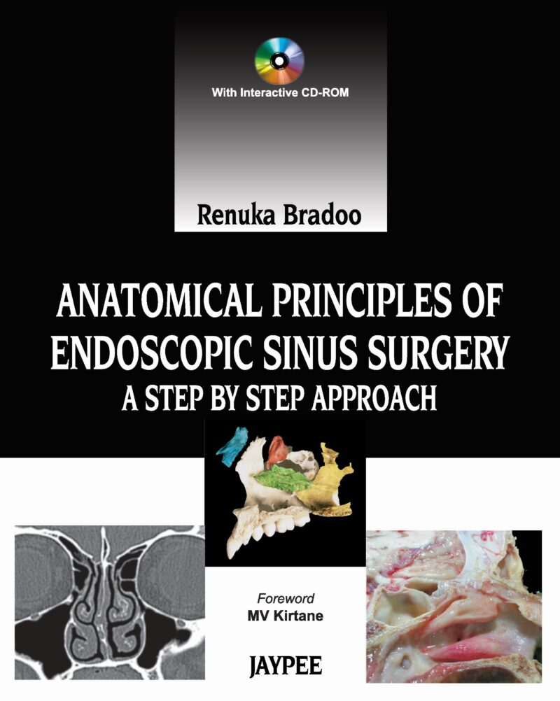 Anatomical Principles of Endoscopic Sinus Surgery Anatomical Principles of Endoscopic Sinus Surgery