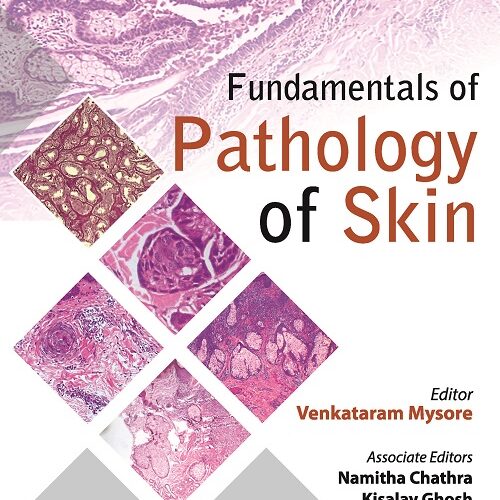Fundamentals of Pathology of Skin by Venkataram Mysore