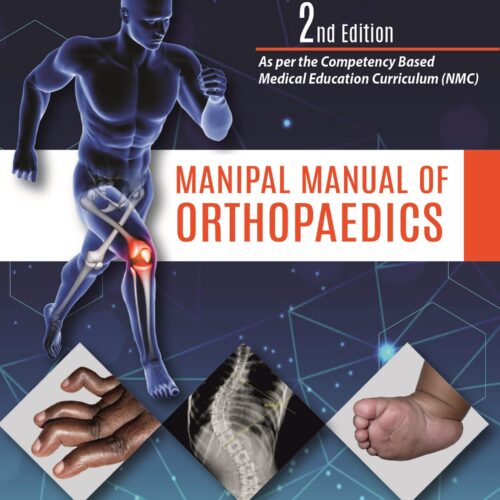 Manipal Manual of Orthopaedics 2 Edition by Vivek Pandey